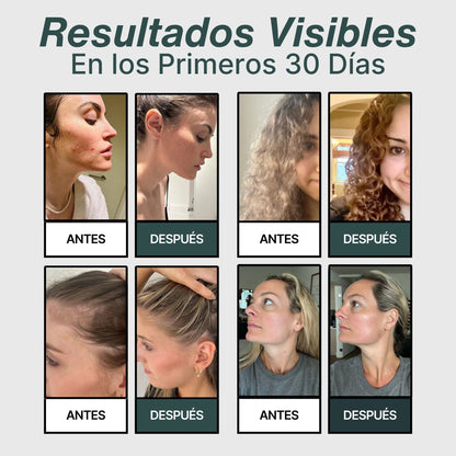 Protege Tu Piel y Tu Cabello del Agua Contaminada – Cabezal AURA®